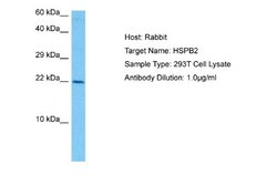 HspB2 Rabbit anti-Human, Polyclonal, Novus Biologicals 0.1 mL | Buy Online | Novus Biologicals | Fisher Scientific
